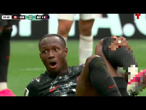 Video thumbnail: Ismael Kone Breaks Leg at World Cup vs Qatar - Doctor Explains
