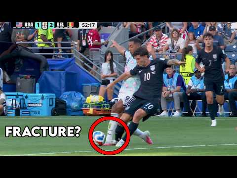 Video thumbnail: Christian Pulisic Broke His Leg vs Belgium (Kind of) - Doctor Explains