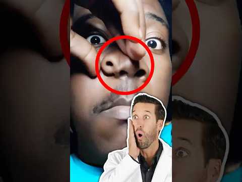 Video thumbnail: ER Doctor REACTS to "Extra" Nose