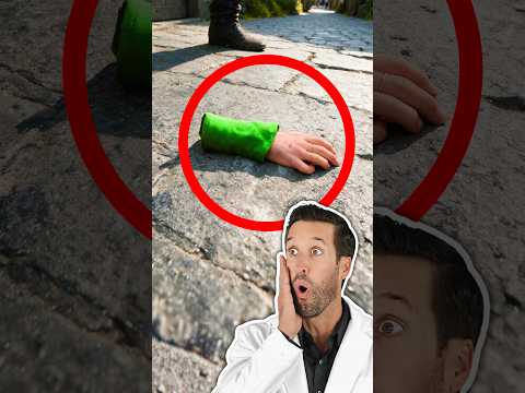 Video thumbnail: ER Doctor REACTS to Arm "Removal" in House of the Dragon