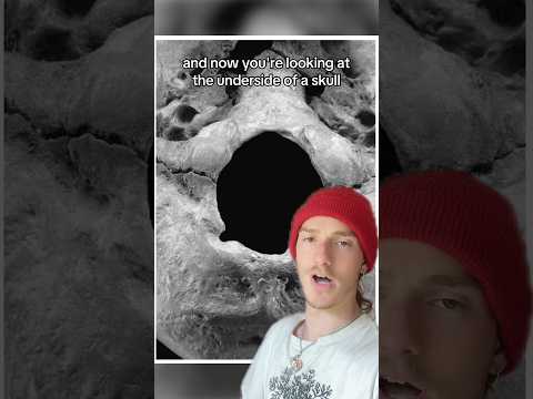Video thumbnail: This Skull Has A Secret