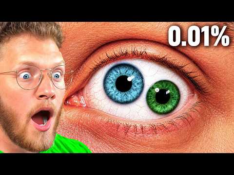 Video thumbnail: Rarest Human Mutations